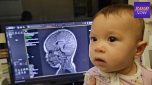 UH study of infant brain development and microplastis funding with $3.3M federal grant